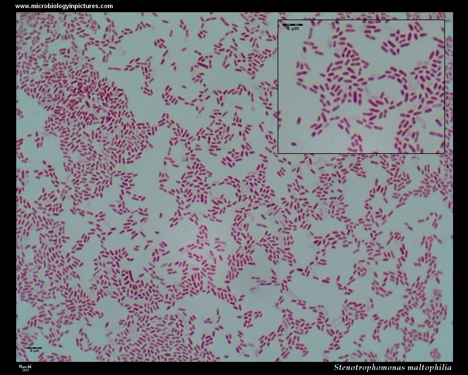 Stenotrophomonas maltophilia Gram stain.