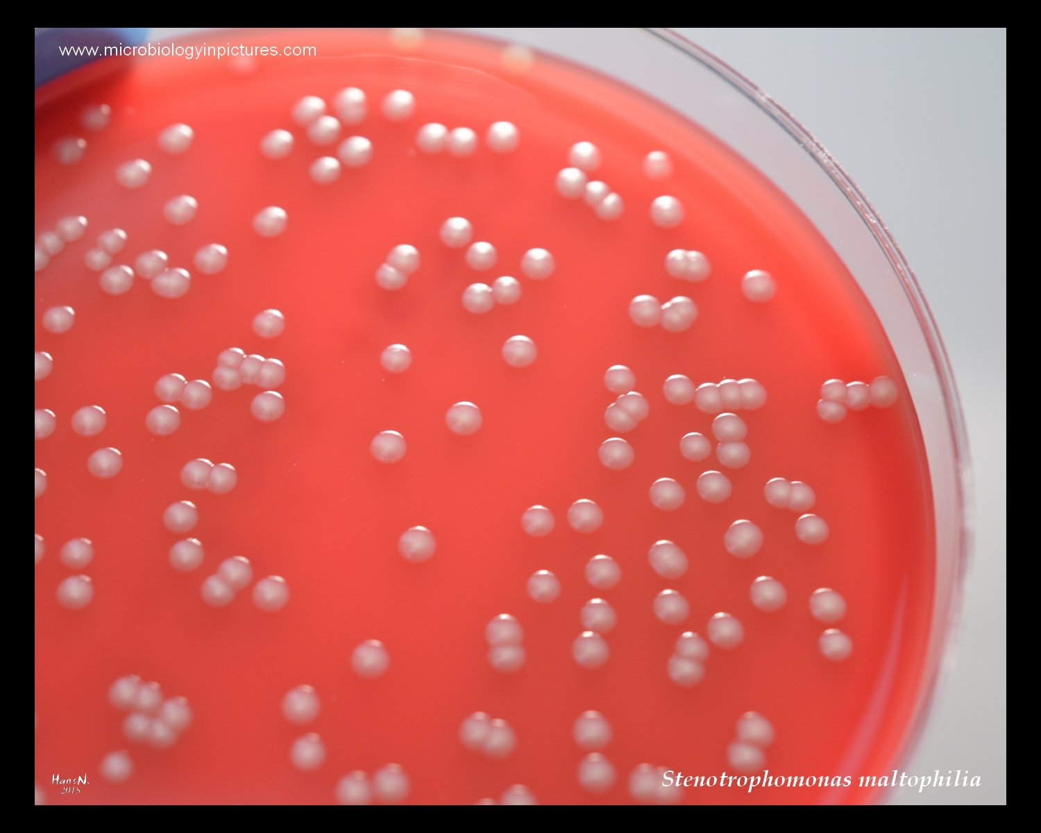 Stenotrophomonas Maltophilia Growth On Blood Agar   Stenotrophomonas Maltophilia 5 