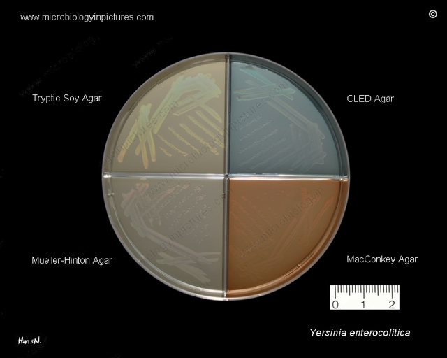 growth of y.enterocolitica on various media used in microbiology