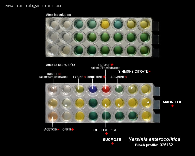 lysine decarboxylase test reaction