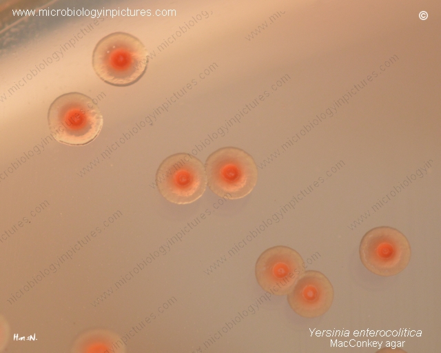 growth of y.enterocolitica colonies on macconkey, colony morphology