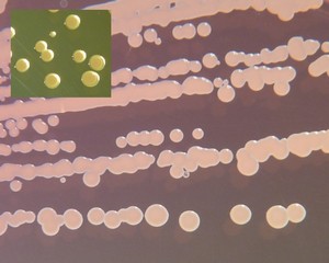 Staphylococcus aureus, Gram-stained S. aureus viewed under …