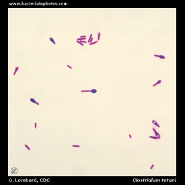 Bacteria under microscope - microscopic appearance of bacteria ...