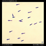 Bacteria under microscope - microscopic appearance of bacteria ...