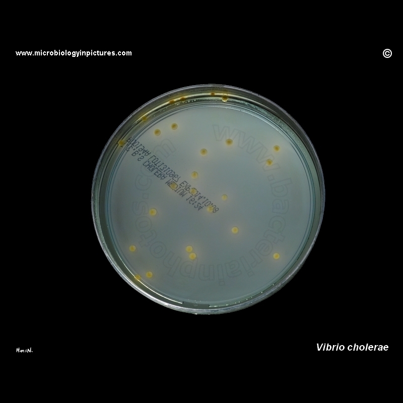 vibrio cholerae TCBS