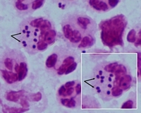 Neisseria gonorrhoeae in macrophages