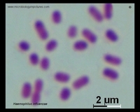 Gram-stained cells of H.influenzae