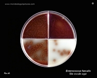 Enterococcus faecalis growing on bile esculin agar