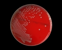pasteurella multocida on blood agar