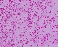 Gram stain of pasteurella multocida