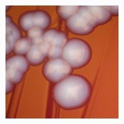 typical colony of E.coli without hemolysis