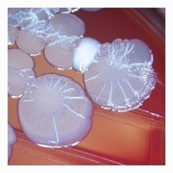 Heterogeneous colonies of E.coli