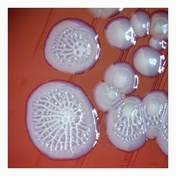 smooth to uneven colonies after prolonged cultivation¨, atypical colonies