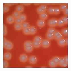 convex colonies with clear beta-hemolysis