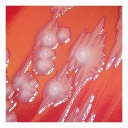 irregular colonies with lobate margins