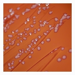 small-colony phenotype, nonhemolytic, nonpigmented colonies