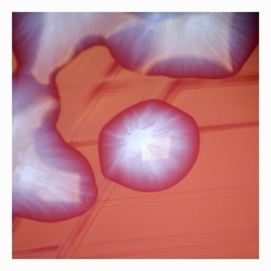 mucoid colonies typical of encapsulated uropathogenic strains of E.coli