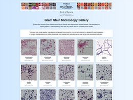 Bacteria microscopy and Gram-stain gallery bacteria microscopy and Gram-stain