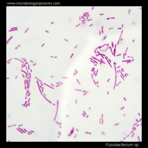 Bacteria under the microscope. Bacteria micrographs, light microscopy ...