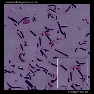 Bacteria under the microscope. Bacteria micrographs, light microscopy ...