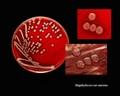 Staphylococcus epidermidis - microbewiki