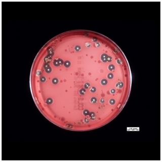 beta-hemolysis on blood agar