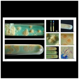 mycobacterium tuberculosis