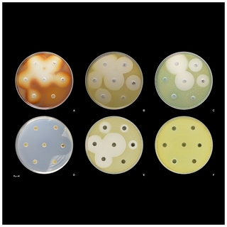 p.aeruginosa disk diffusion tests