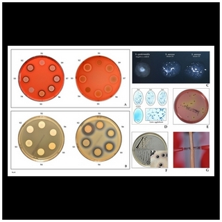 Staphylococcus aureus - Wikipedia
