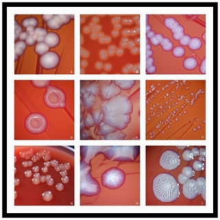 Escherichia coli colony variability